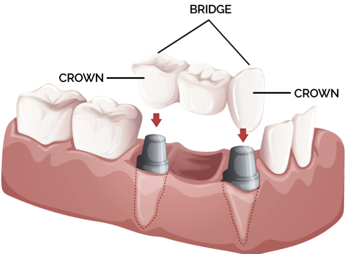 cosmetic dentist in udaipur